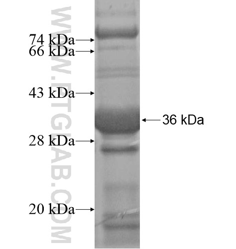 TMX4 fusion protein Ag15712 SDS-PAGE TMX4 fusion protein Ag15712 SDS-PAGE