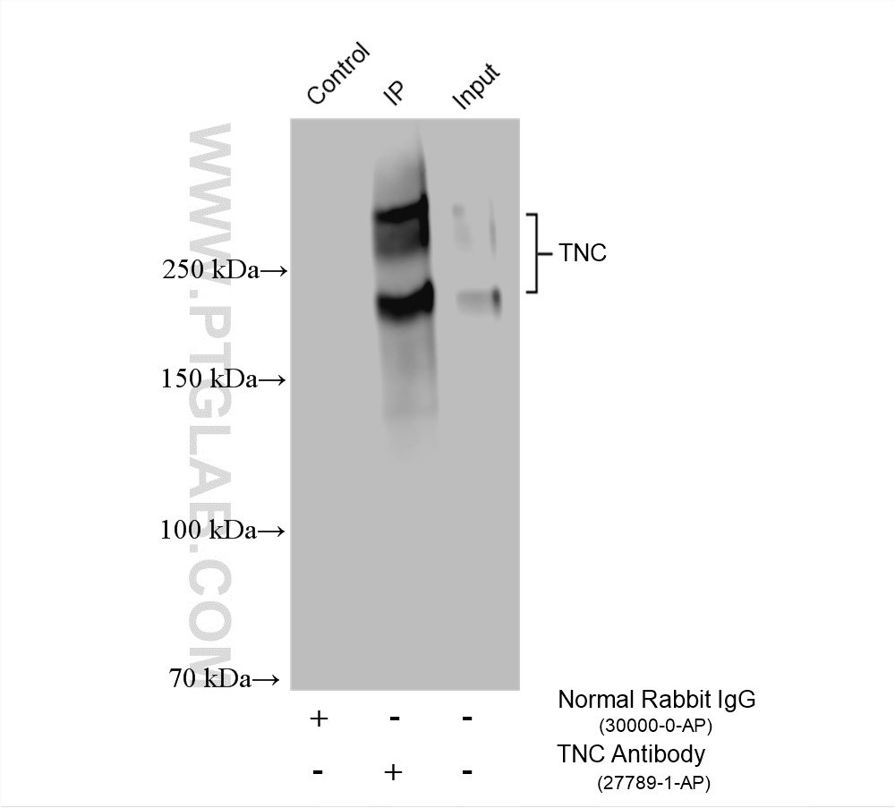 IP result of anti-TNC/Tenascin-C (IP:27789-1-AP, 4ug; Detection:27789-1-AP 1:3000) with U-87 MG cells lysate 1400 ug. IP experiment of U-87 MG using 27789-1-AP
