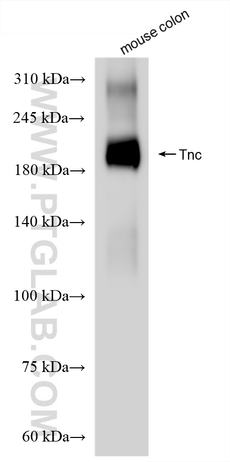 WB analysis of mouse colon using 85821-1-RR