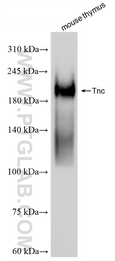 WB analysis of mouse thymus using 85821-1-RR