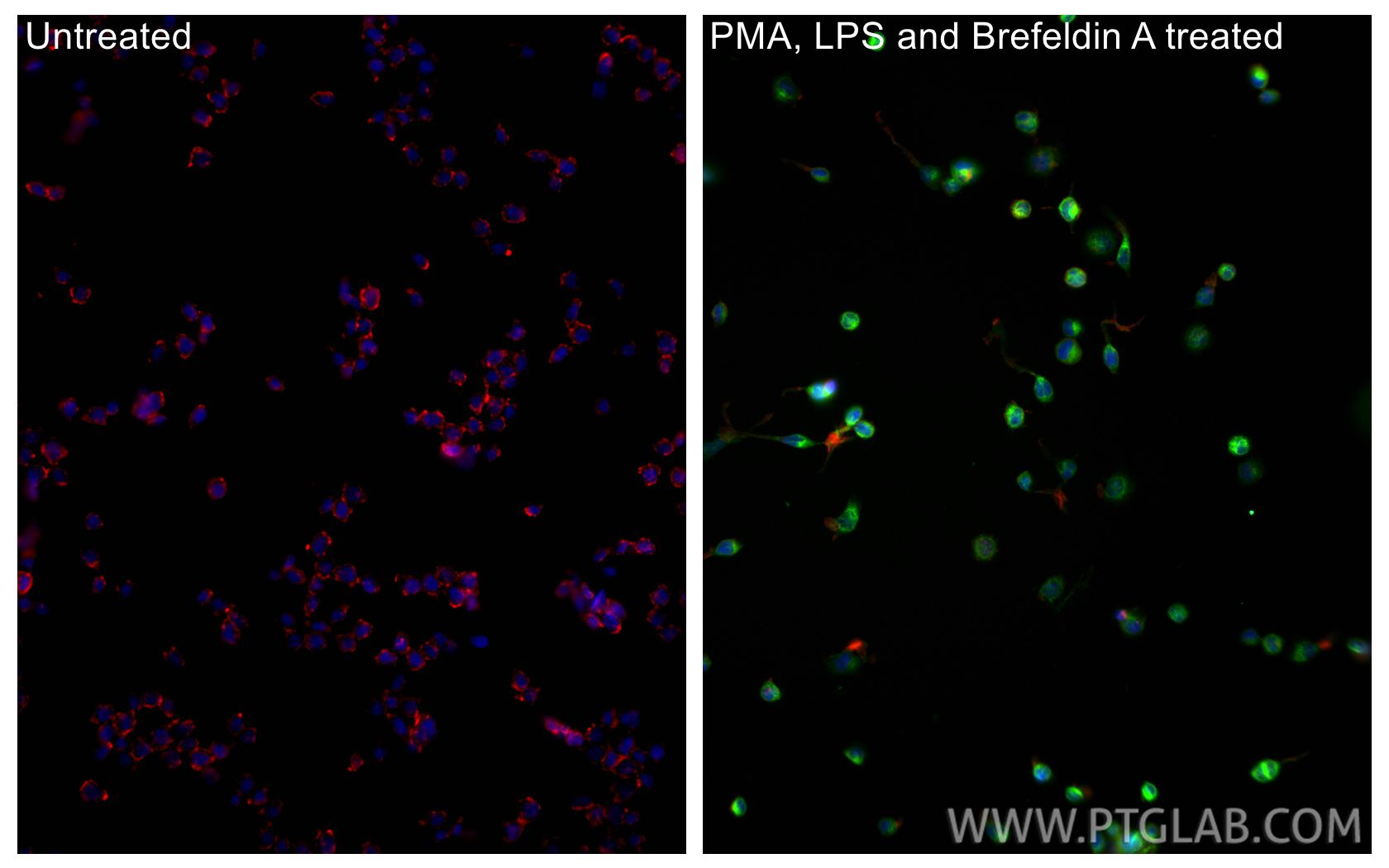 IF Staining of THP-1 using CL488-17590