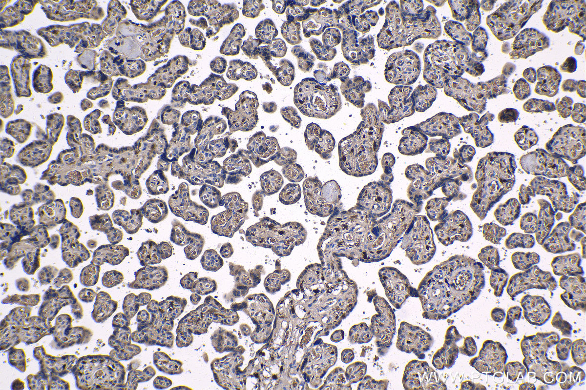 IHC staining of human placenta using 60291-1-Ig
