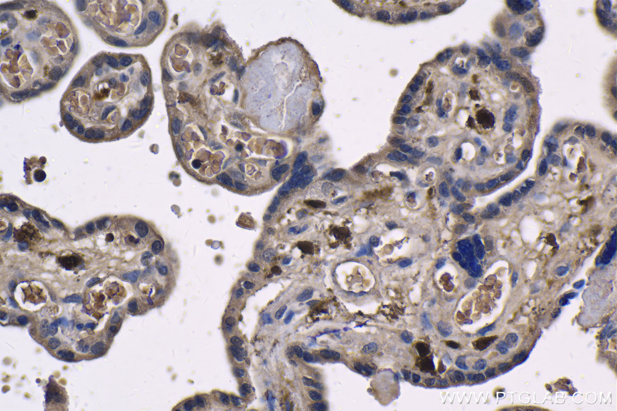 IHC staining of human placenta using 60291-1-Ig