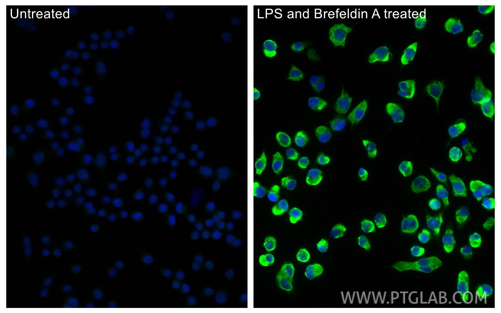 IF Staining of RAW 264.7 using 26162-1-AP IF Staining of RAW 264.7 using 26162-1-AP