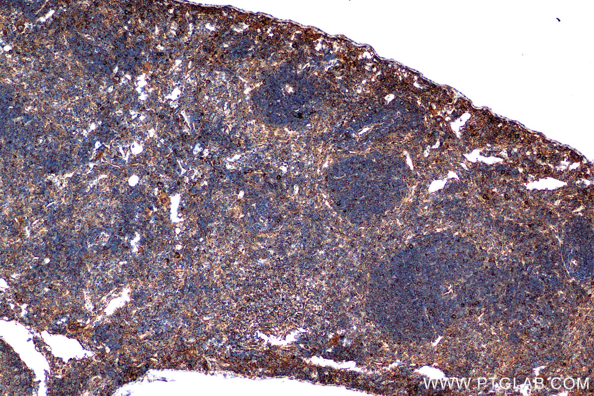 Immunohistochemical analysis of paraffin-embedded mouse spleen tissue slide using <a class='green' href='/productredirect?CatalogNo=80260-2-RR' target='_blank'>80260-2-RR</a> (Tnfa antibody) at dilution of 1:2000 (under 10x lens). This data was developed using the same antibody clone with 80260-2-PBS in a different storage buffer formulation. IHC staining of mouse spleen using 80260-2-RR (same clone as 80260-2-PBS)