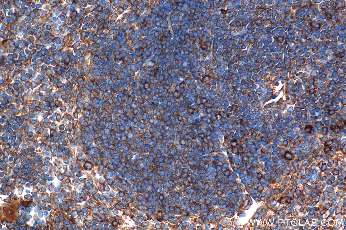 Immunohistochemical analysis of paraffin-embedded mouse spleen tissue slide using <a class='green' href='/productredirect?CatalogNo=80260-2-RR' target='_blank'>80260-2-RR</a> (Tnfa antibody) at dilution of 1:2000 (under 40x lens). This data was developed using the same antibody clone with 80260-2-PBS in a different storage buffer formulation. IHC staining of mouse spleen using 80260-2-RR (same clone as 80260-2-PBS)