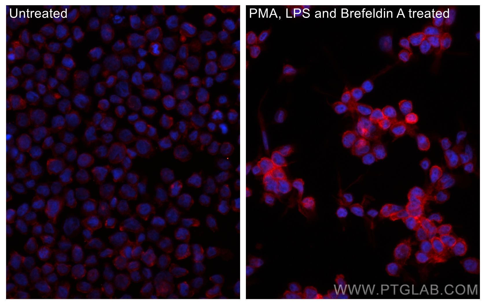 IF Staining of THP-1 using CL594-60291
