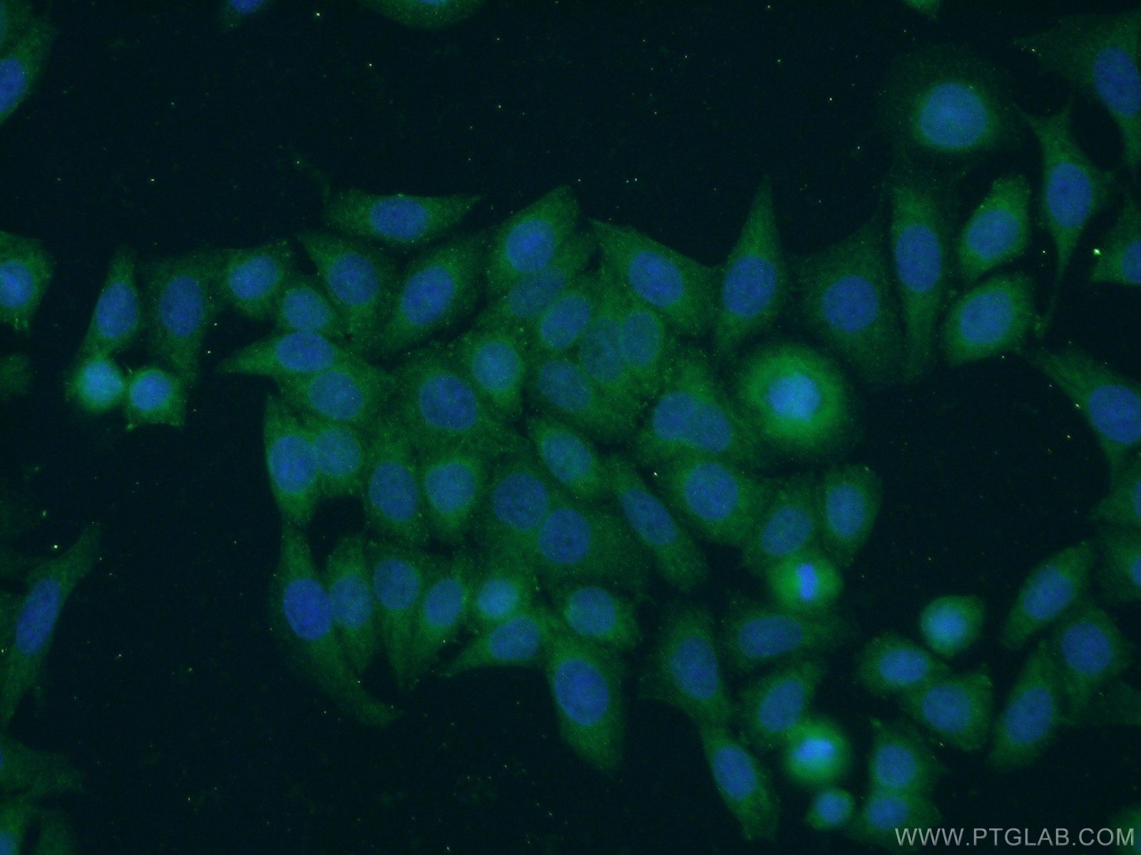 IF Staining of HeLa using 15320-1-AP (same clone as 15320-1-PBS)