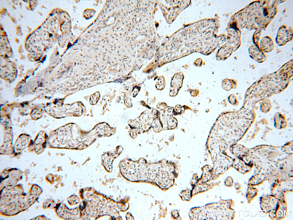 IHC staining of human placenta using 15320-1-AP (same clone as 15320-1-PBS)