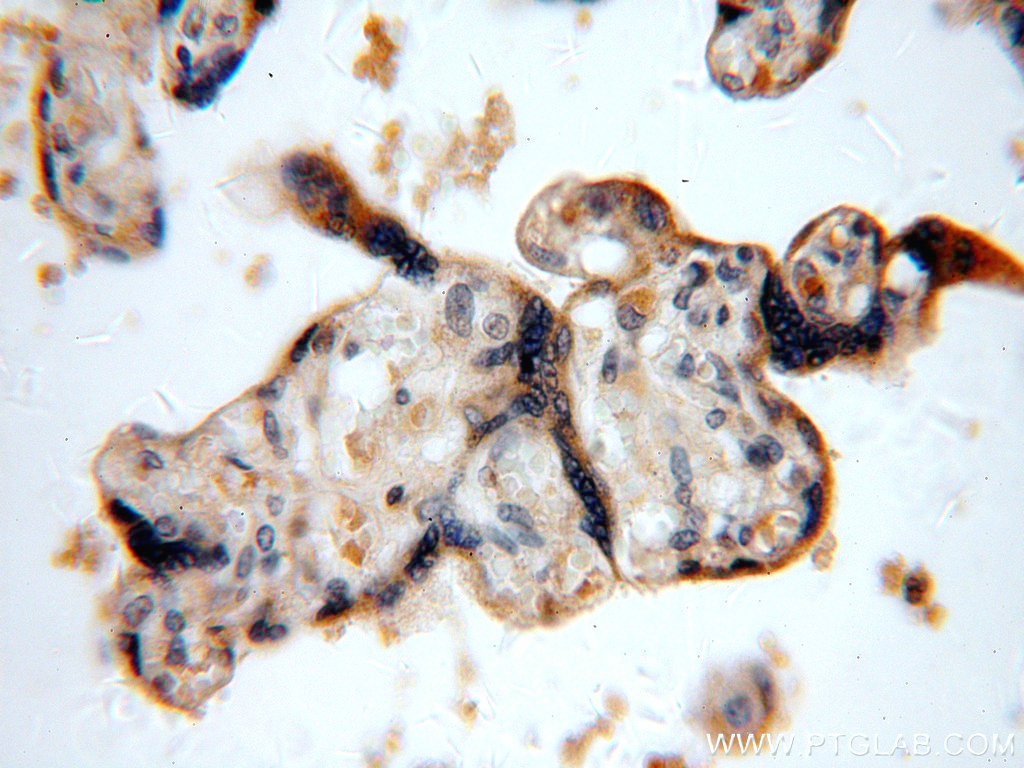 IHC staining of human placenta using 15320-1-AP (same clone as 15320-1-PBS)