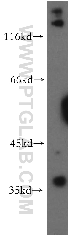 WB analysis of HeLa using 15320-1-AP (same clone as 15320-1-PBS)