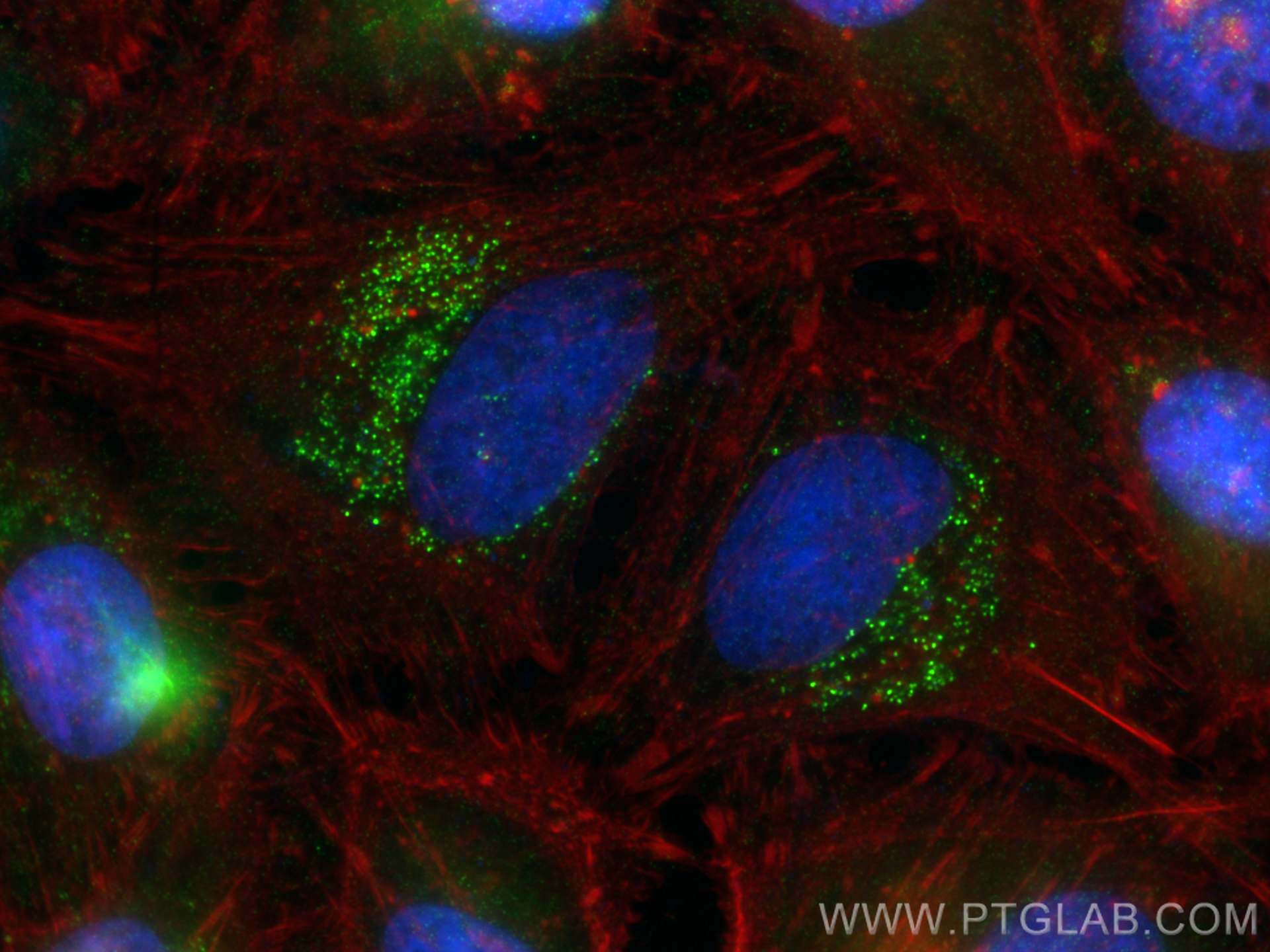 IF Staining of HeLa using 66695-1-Ig