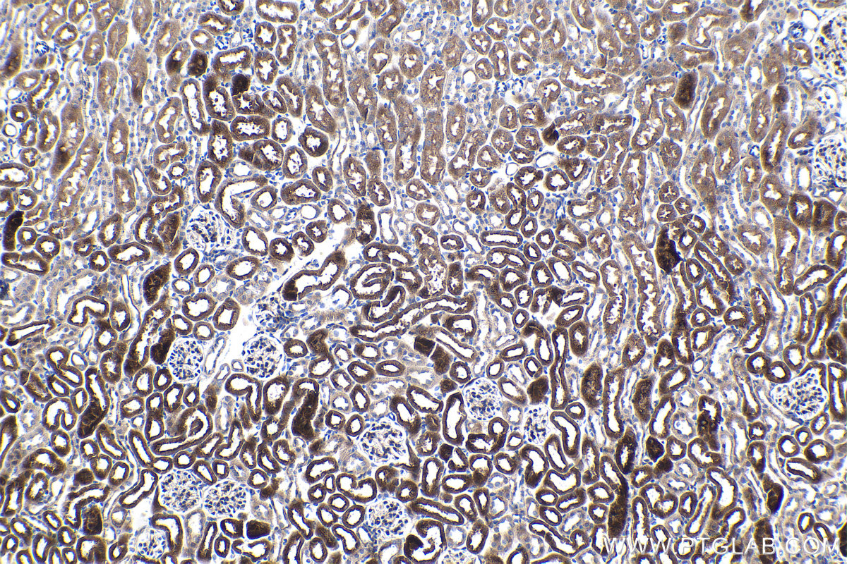 IHC staining of mouse kidney using 66695-1-Ig