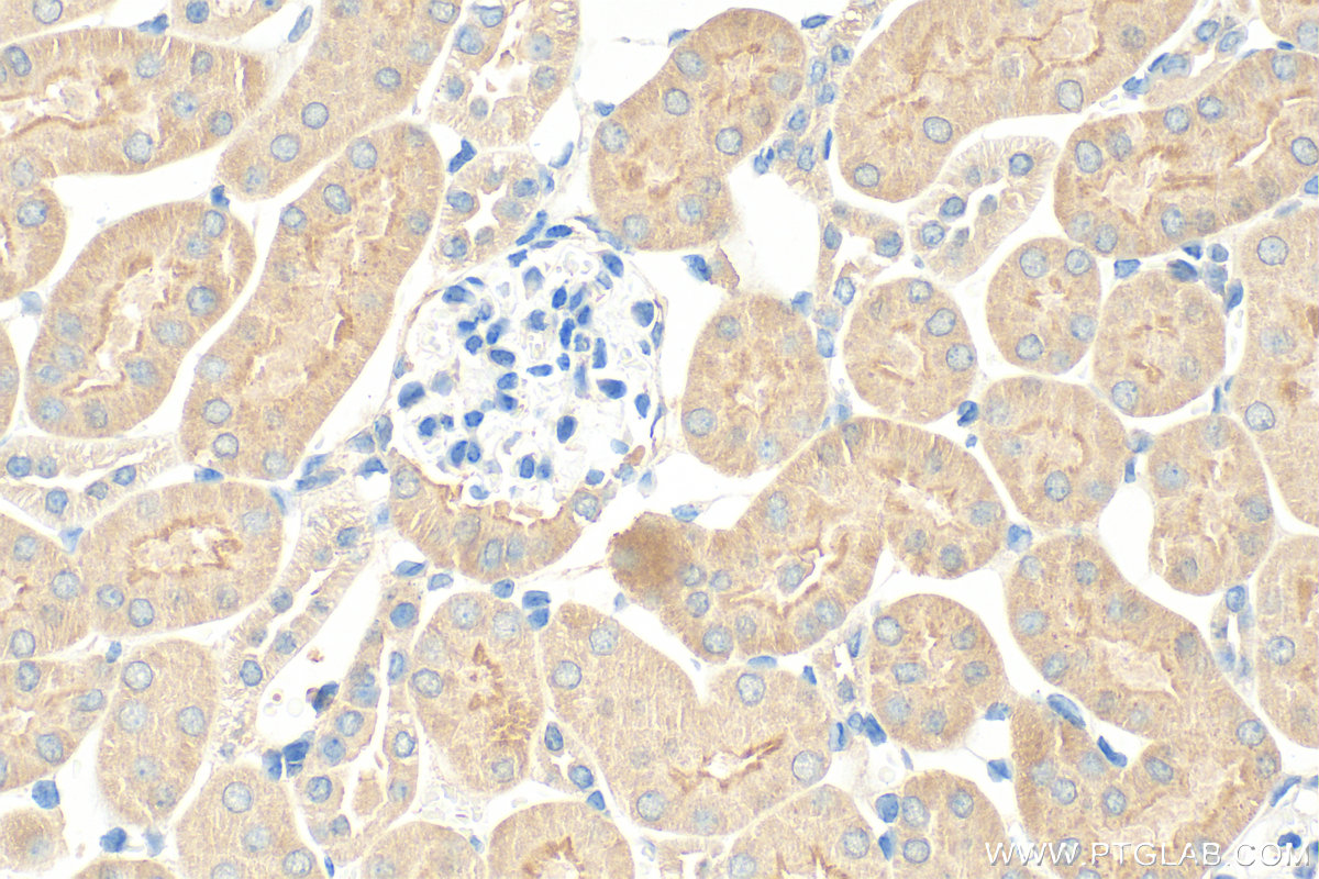 IHC staining of mouse kidney using 66695-1-Ig