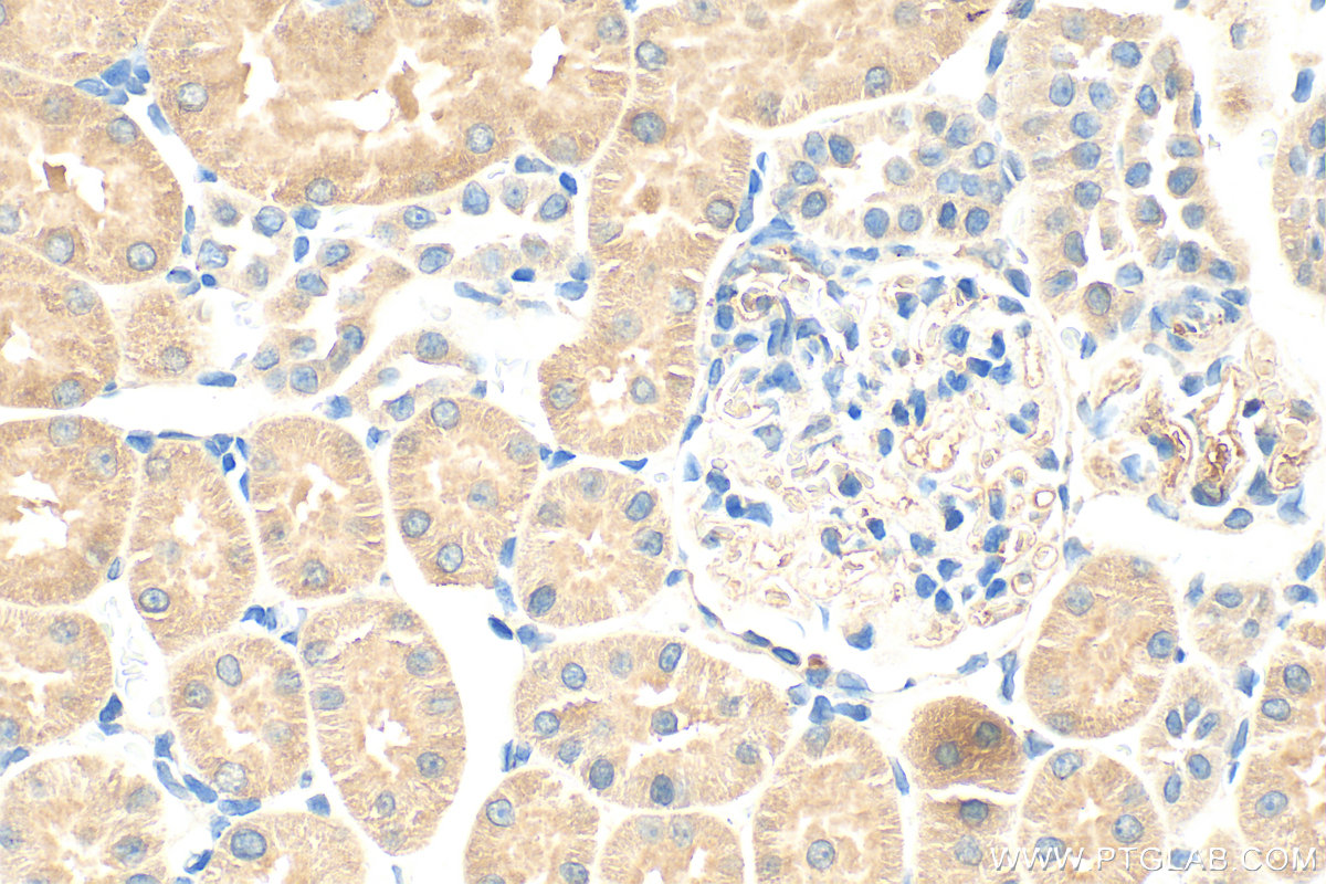 IHC staining of rat kidney using 66695-1-Ig