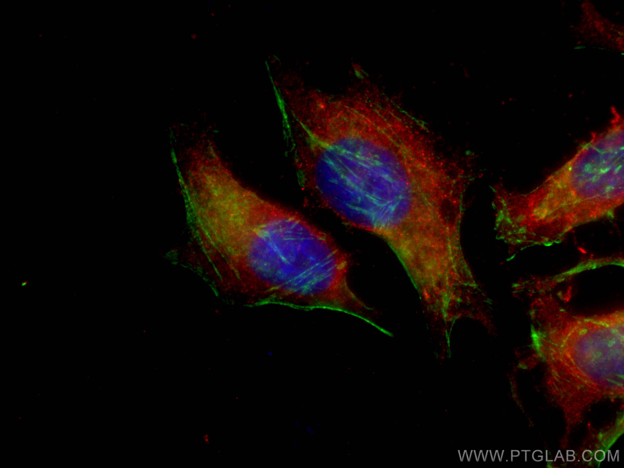 IF Staining of HeLa using CL594-66695