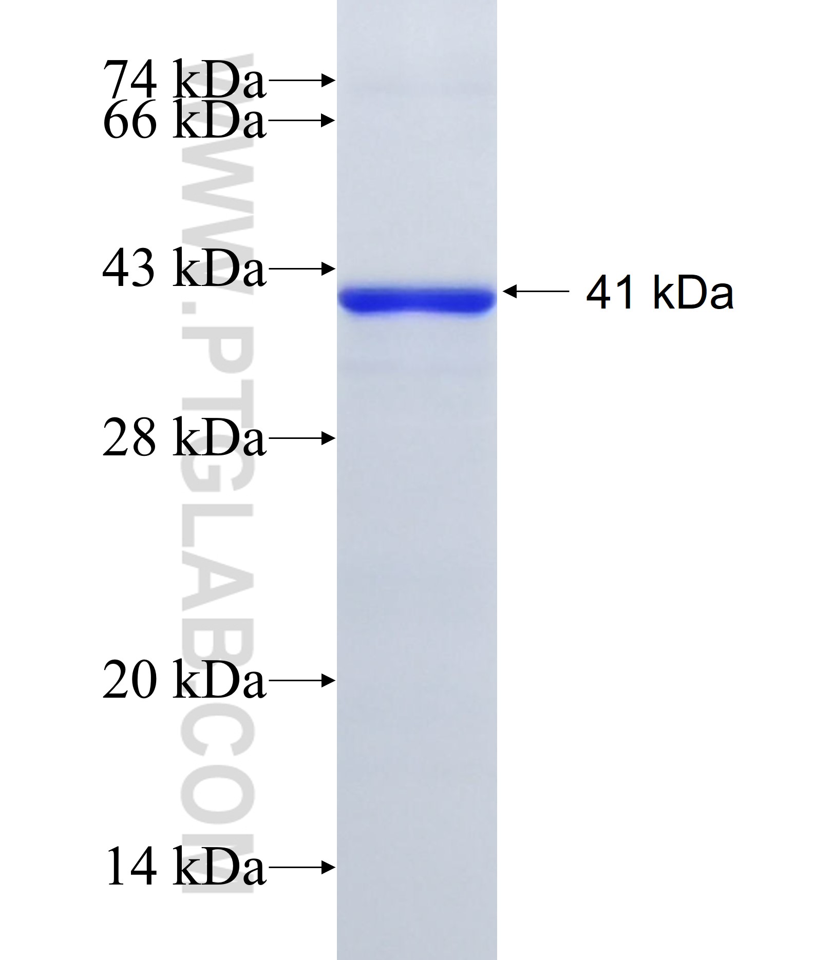 TNFAIP3 fusion protein Ag18150 SDS-PAGE