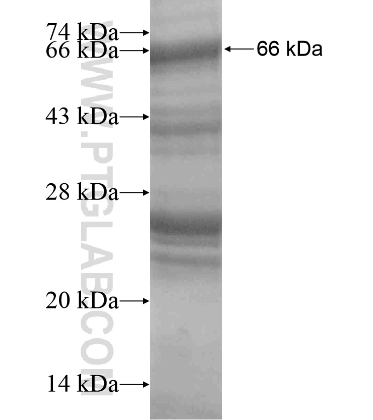 TNFAIP3 fusion protein Ag18466 SDS-PAGE TNFAIP3 fusion protein Ag18466 SDS-PAGE