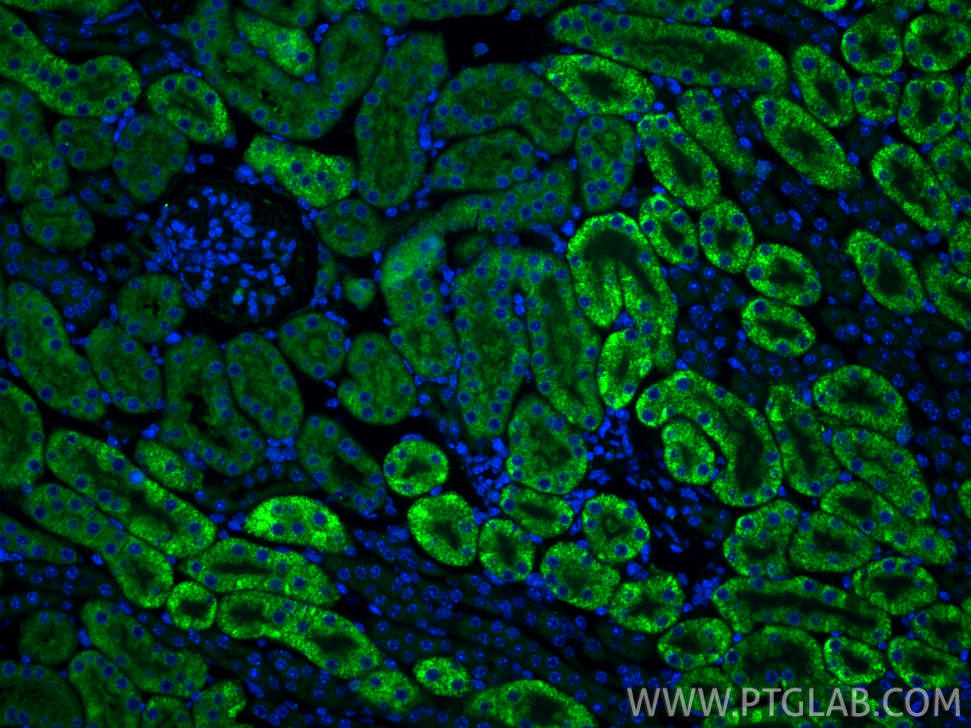 IF Staining of mouse kidney using 13321-1-AP IF Staining of mouse kidney using 13321-1-AP