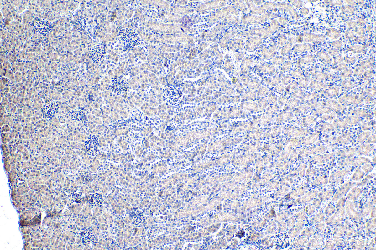 IHC staining of mouse kidney using 13321-1-AP