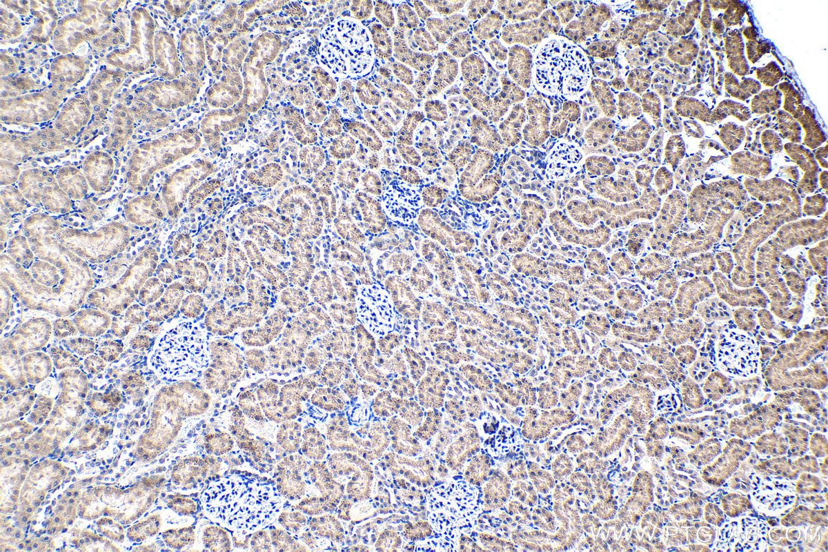 IHC staining of rat kidney using 13321-1-AP