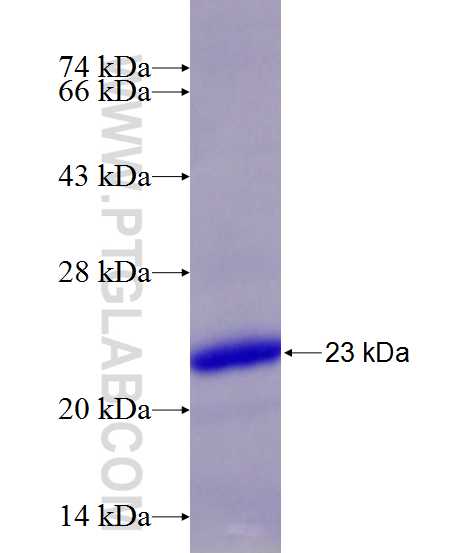 TNFAIP8L1 fusion protein Ag10750 SDS-PAGE TNFAIP8L1 fusion protein Ag10750 SDS-PAGE