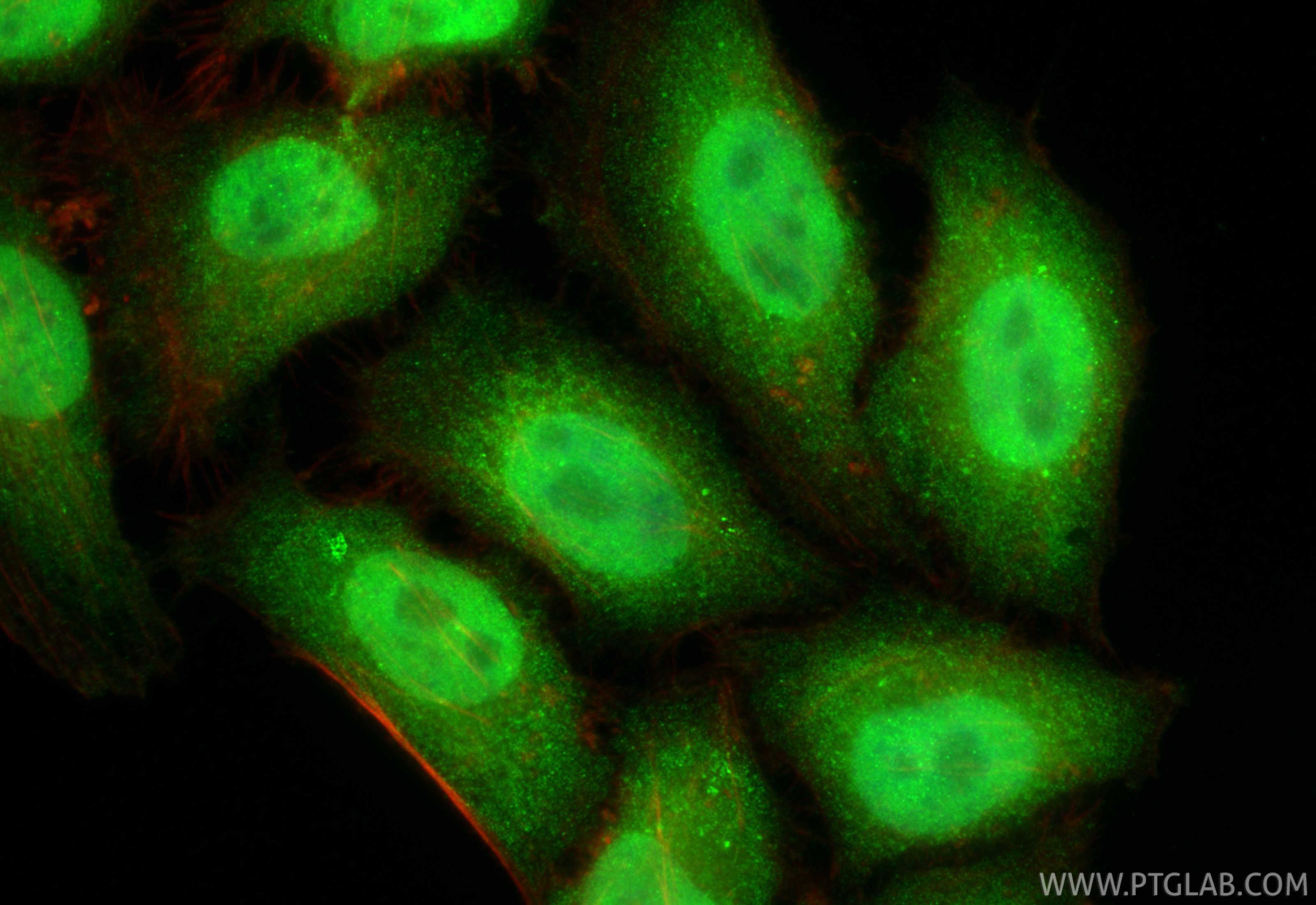 IF Staining of HepG2 using 15940-1-AP