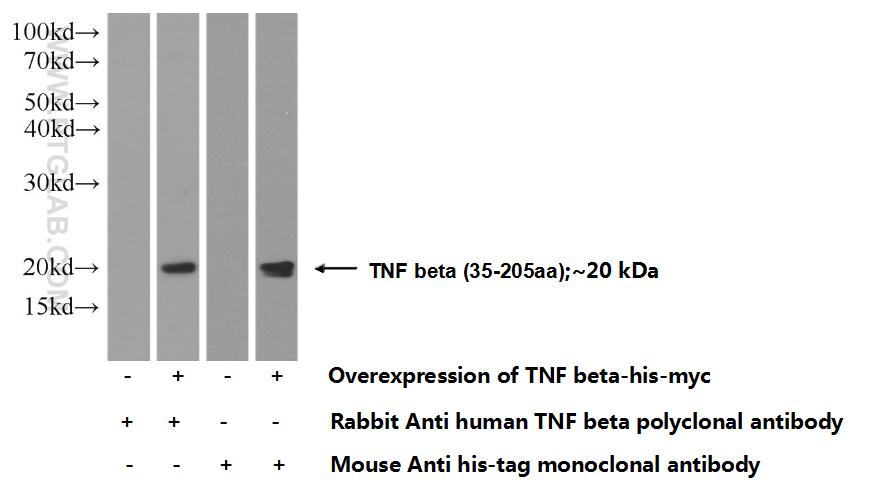 TNF Beta Polyclonal antibody