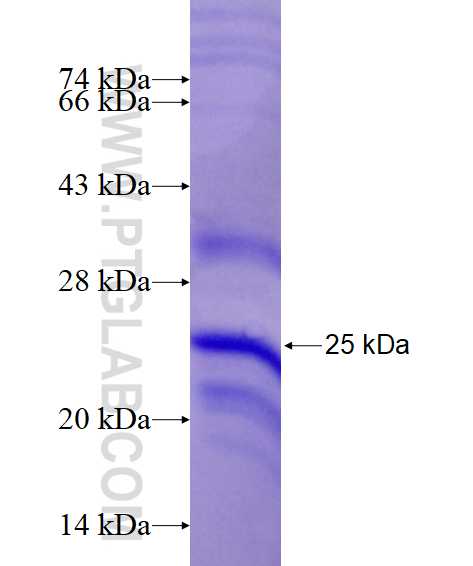 TNFB fusion protein Ag15275 SDS-PAGE