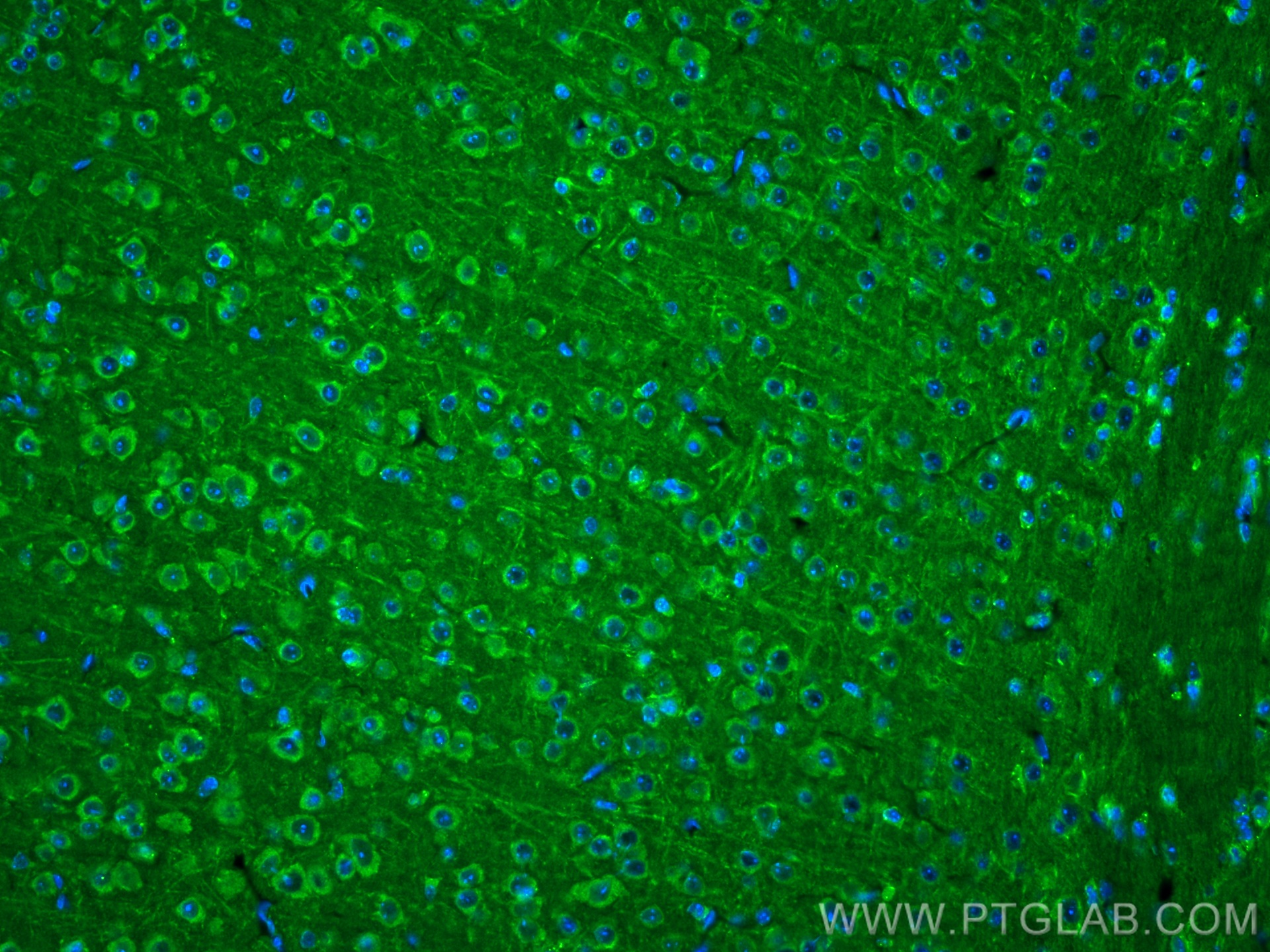 IF Staining of mouse brain using 21574-1-AP