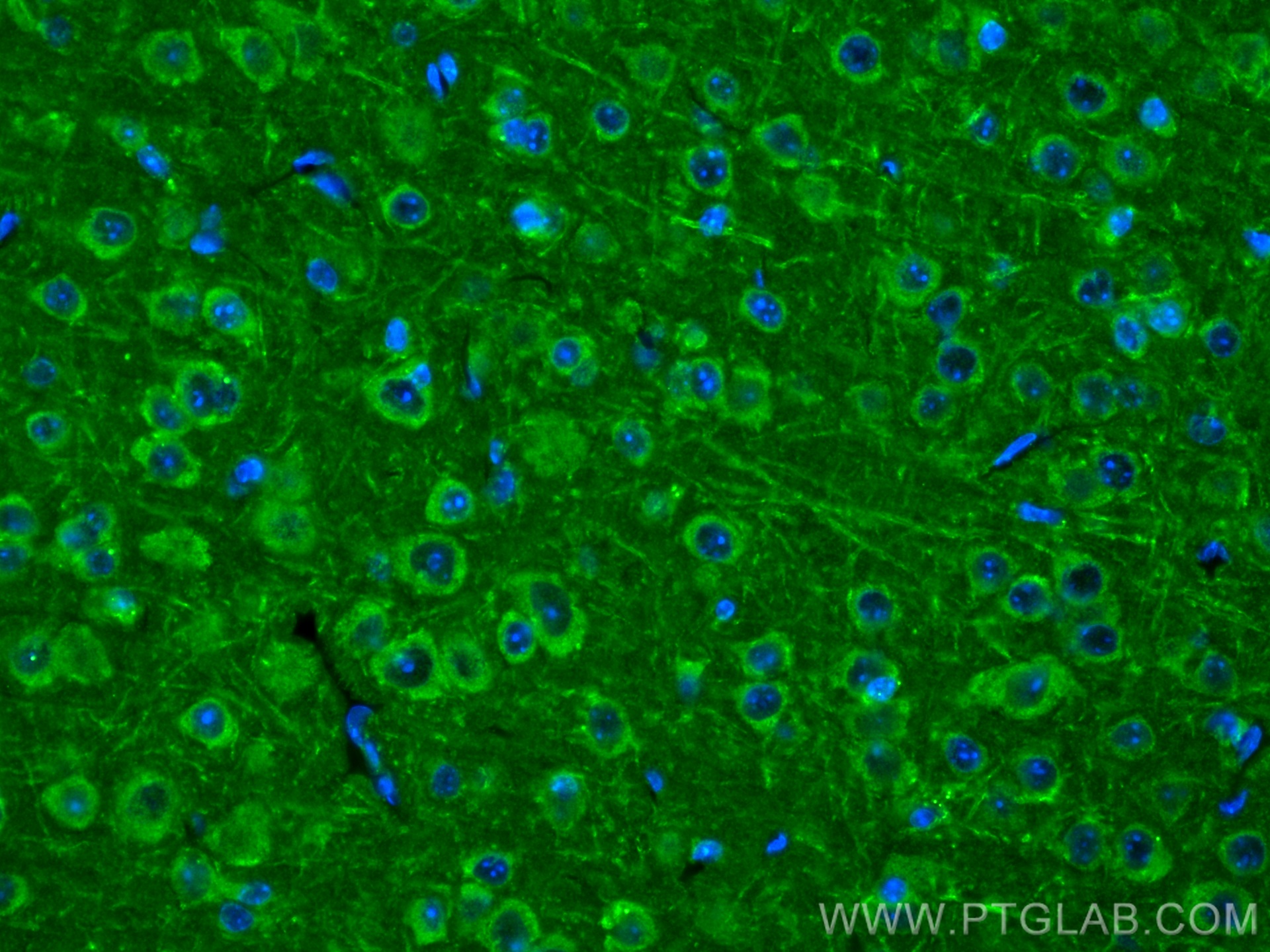 IF Staining of mouse brain using 21574-1-AP
