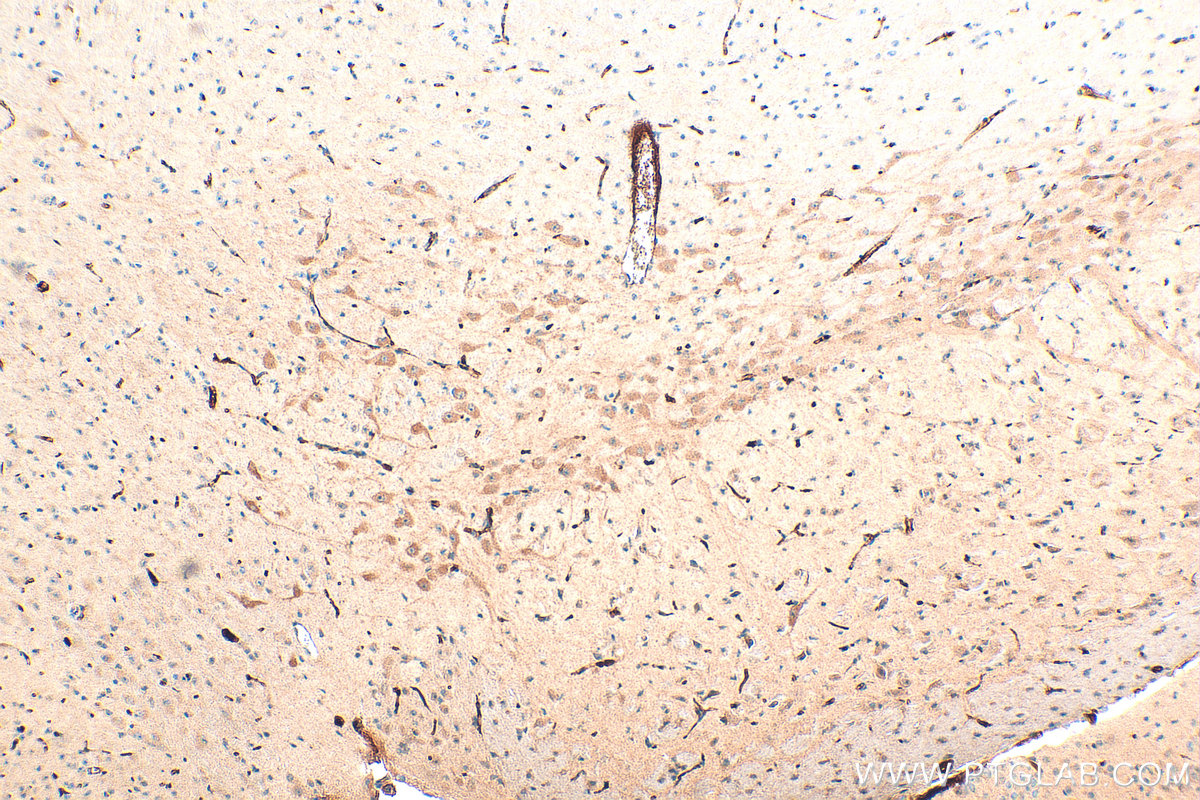 IHC staining of mouse brain using 21574-1-AP