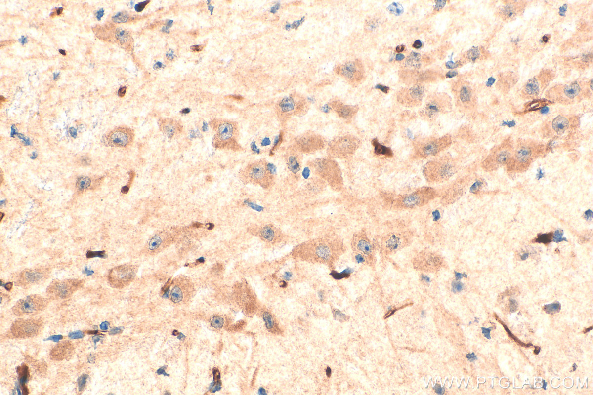 IHC staining of mouse brain using 21574-1-AP