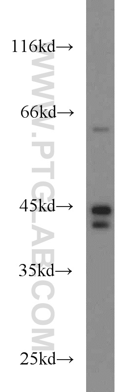 TNFR1 Polyclonal antibody