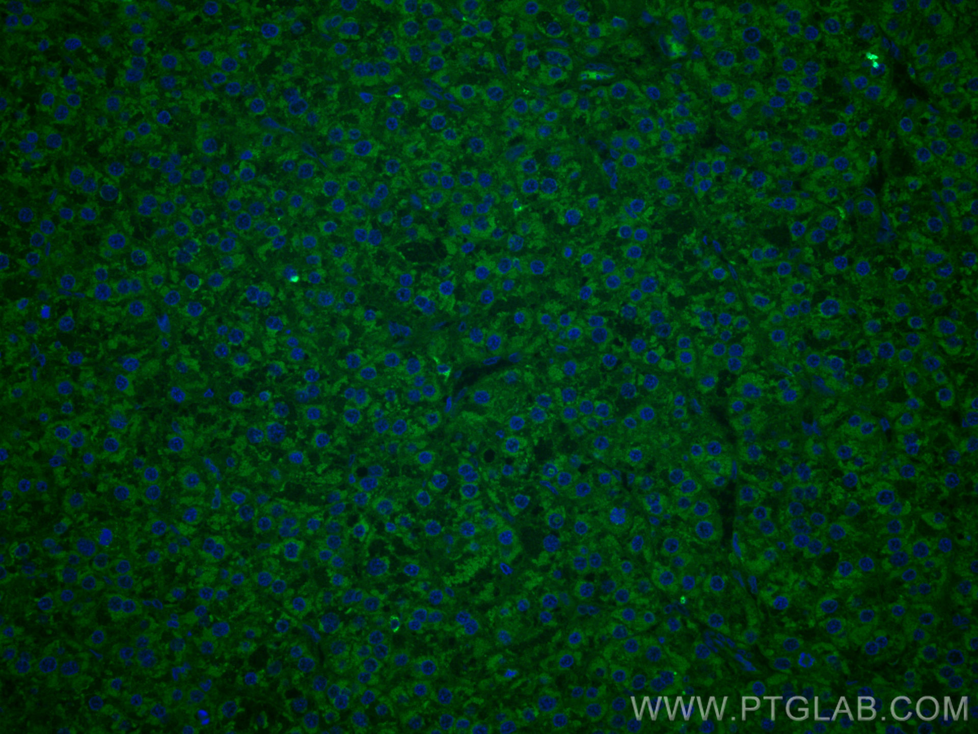 IF Staining of human liver cancer using CL488-60192