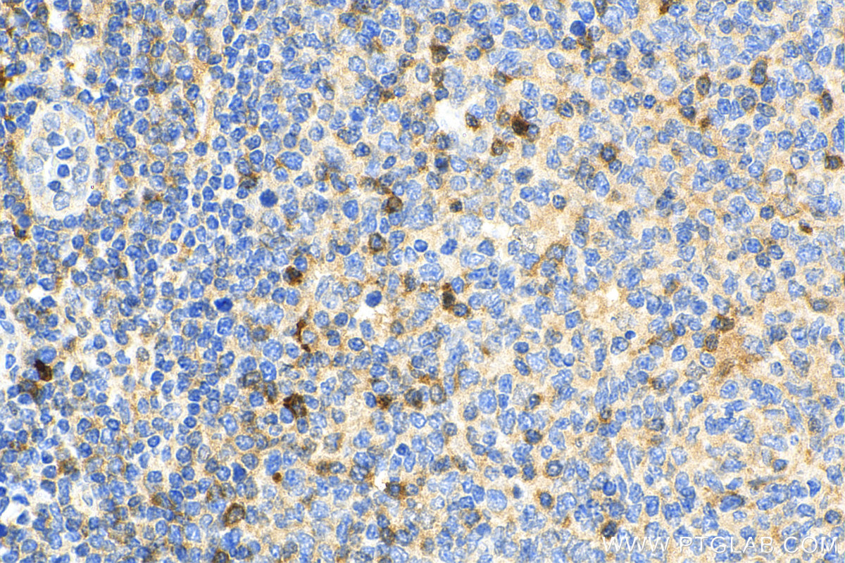 IHC staining of human tonsillitis using 28746-1-AP