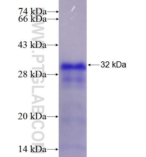 TNFR2 fusion protein Ag5866 SDS-PAGE