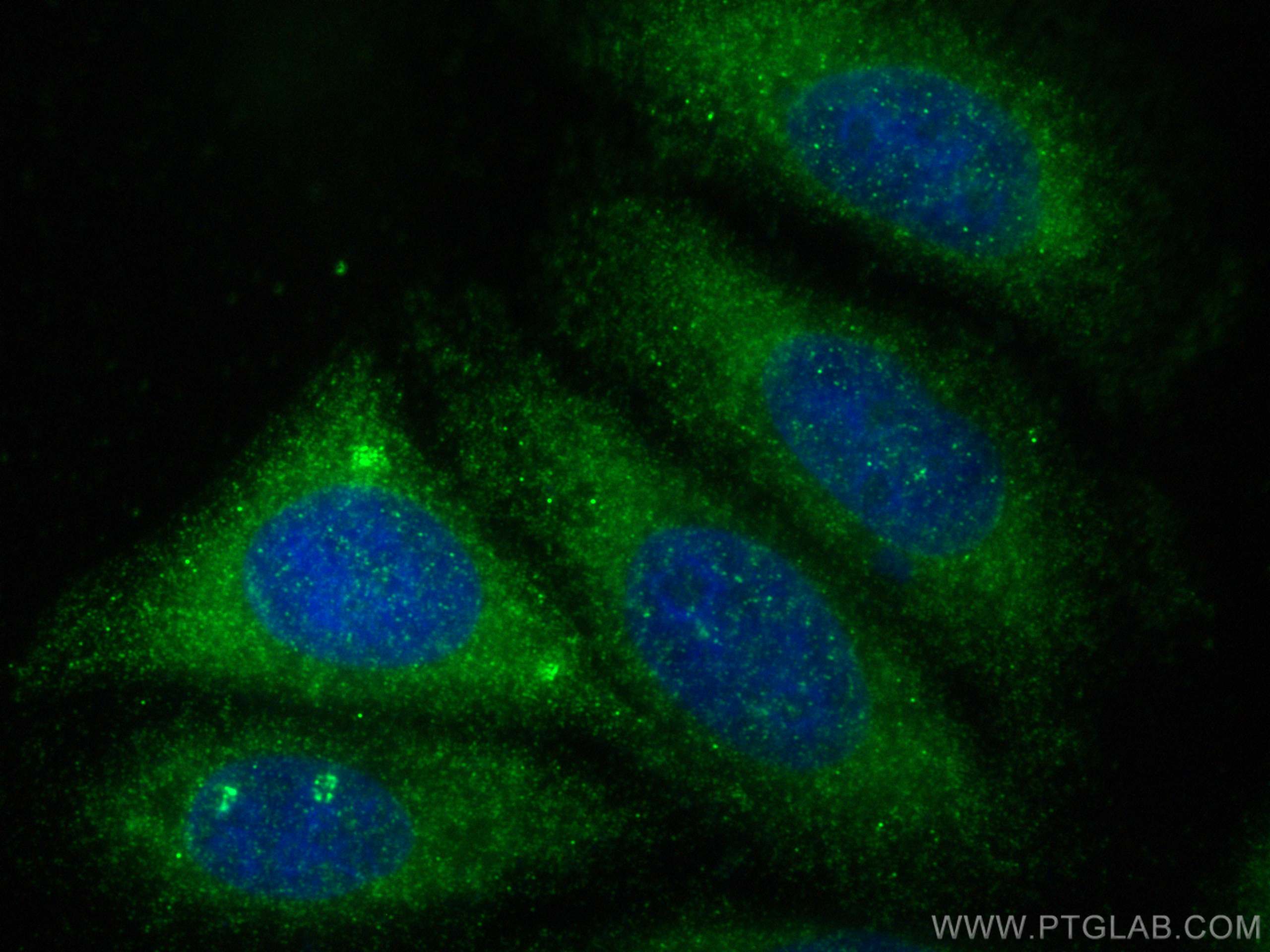 IF Staining of HepG2 using 11534-1-AP