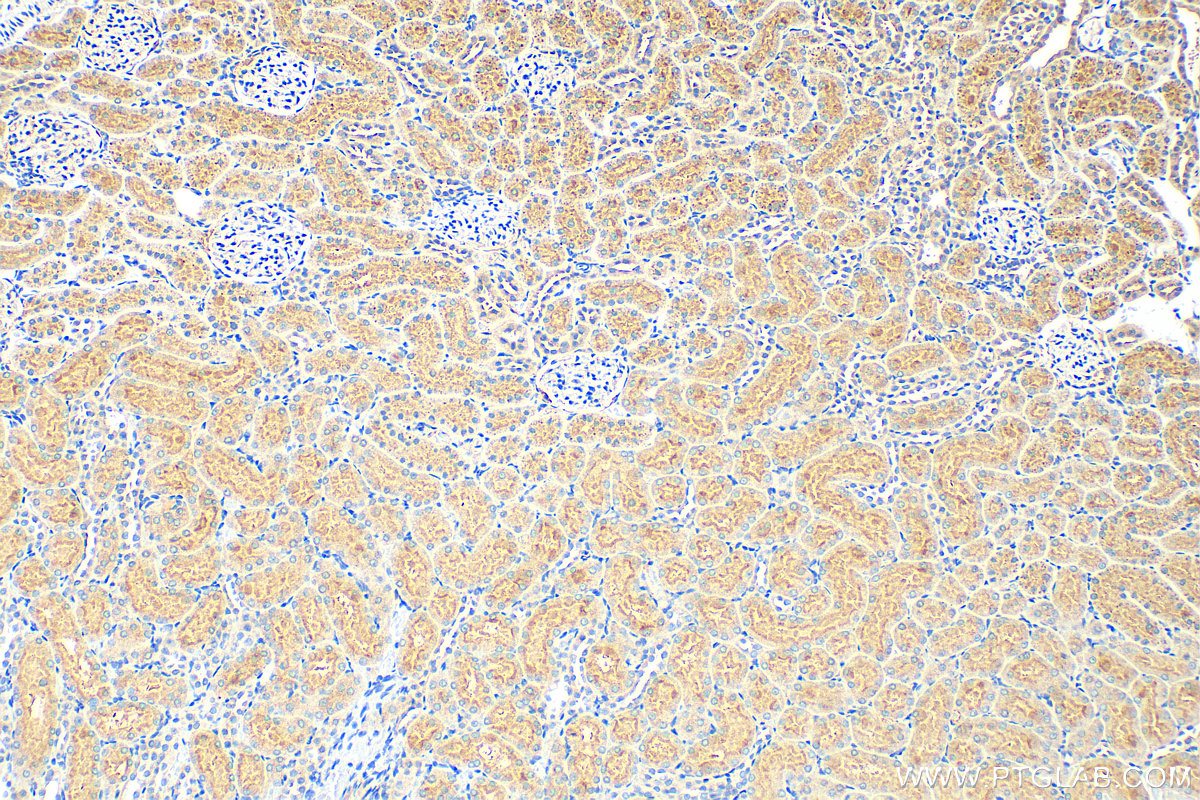 IHC staining of rat kidney using 11534-1-AP