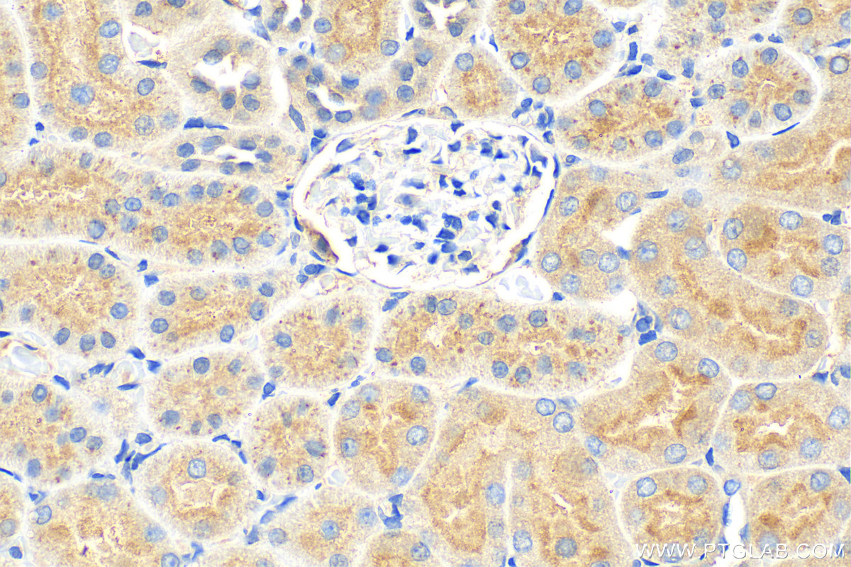 IHC staining of rat kidney using 11534-1-AP