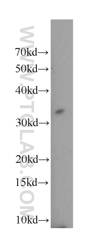 TNFRSF13B/CD267