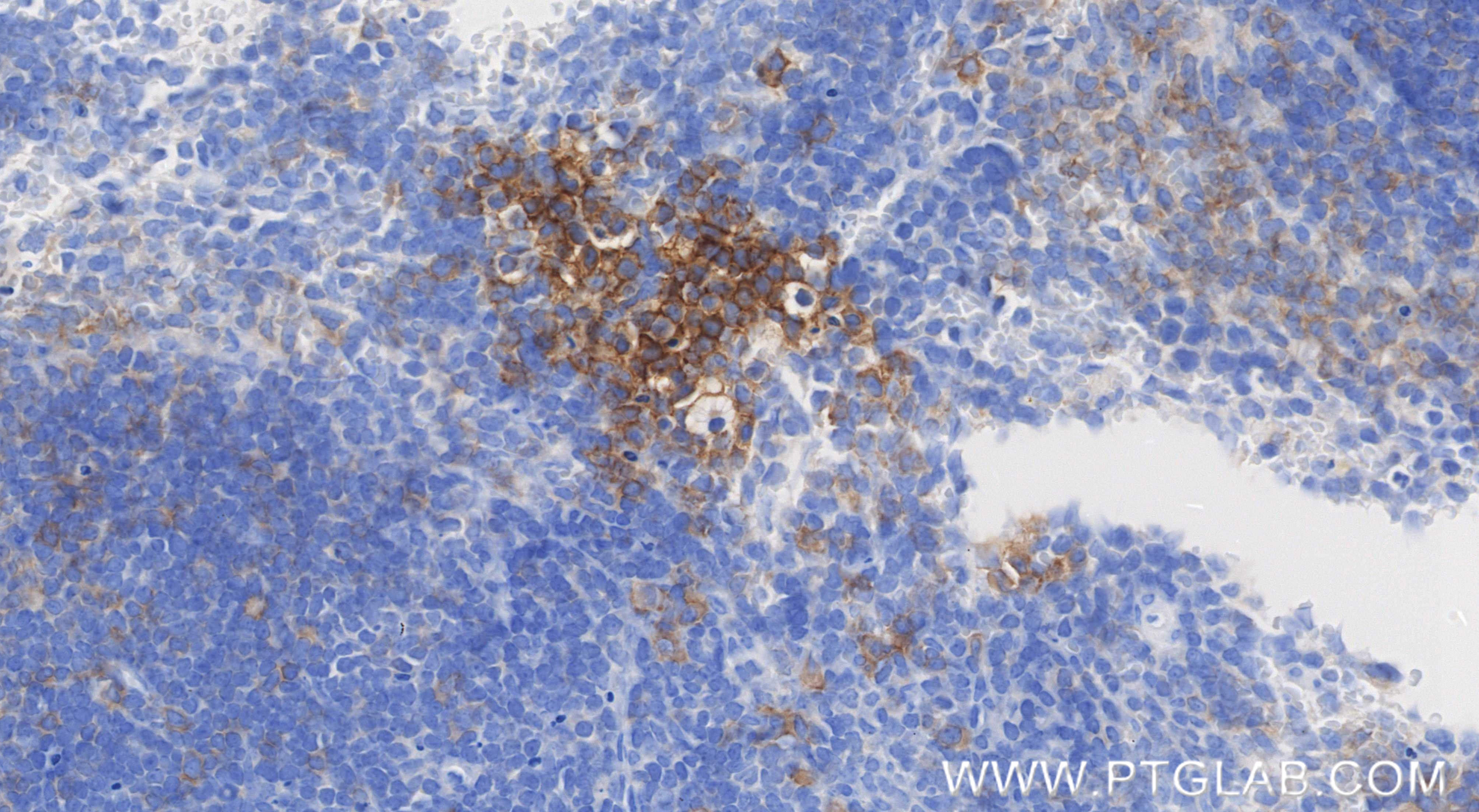 IHC staining of mouse spleen using 85902-1-RR