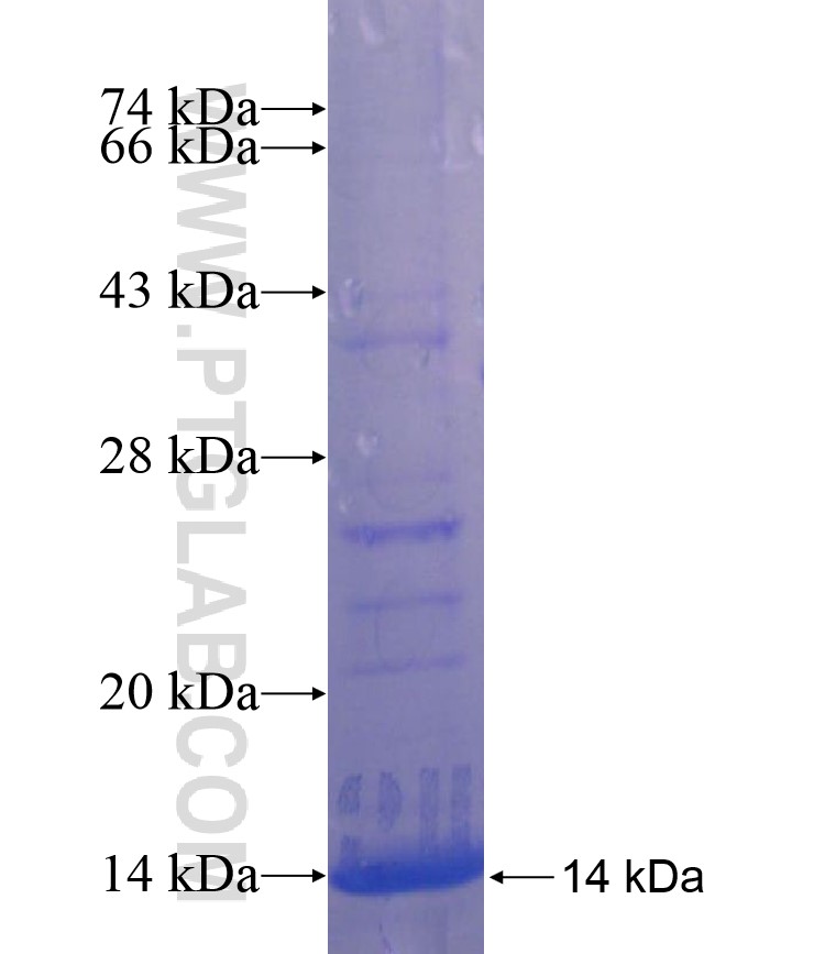 TNFRSF21 fusion protein Ag17097 SDS-PAGE TNFRSF21 fusion protein Ag17097 SDS-PAGE