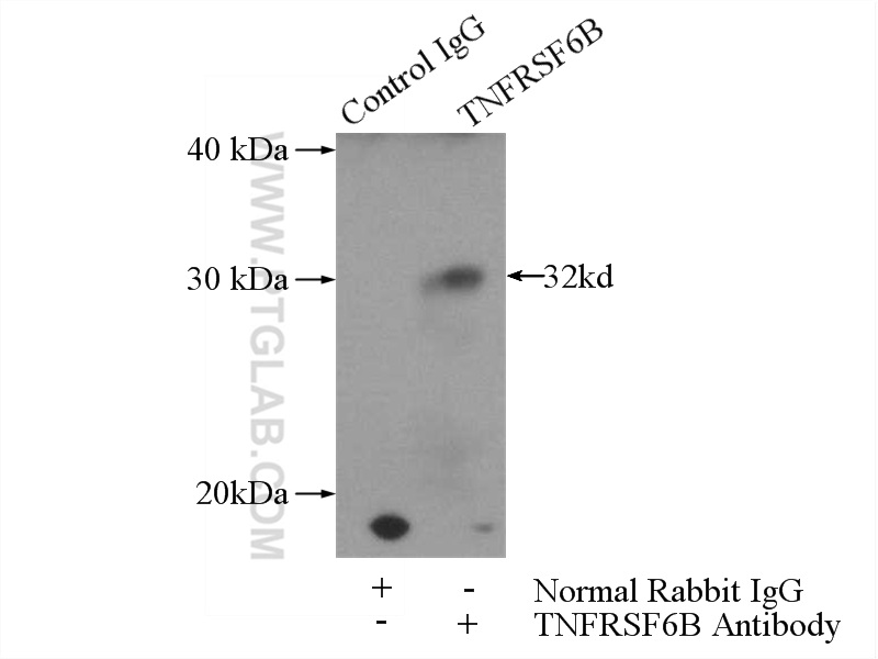 IP experiment of HeLa using 24999-1-AP