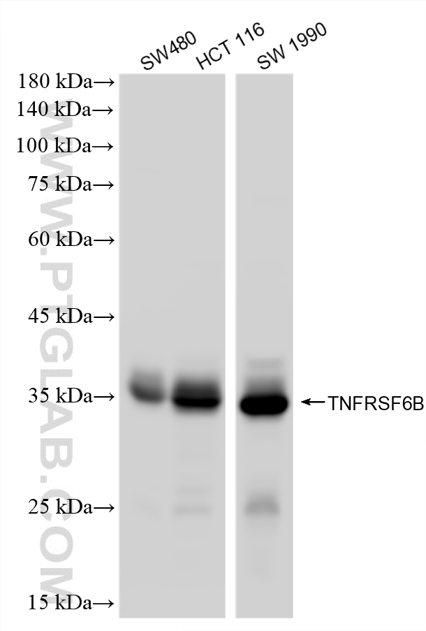 WB analysis using 87840-1-RR WB analysis using 87840-1-RR