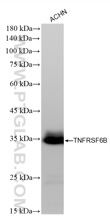 WB analysis of ACHN using 87840-1-RR WB analysis of ACHN using 87840-1-RR