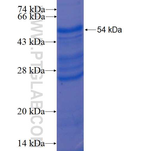 TNFRSF9 fusion protein Ag0792 SDS-PAGE TNFRSF9 fusion protein Ag0792 SDS-PAGE