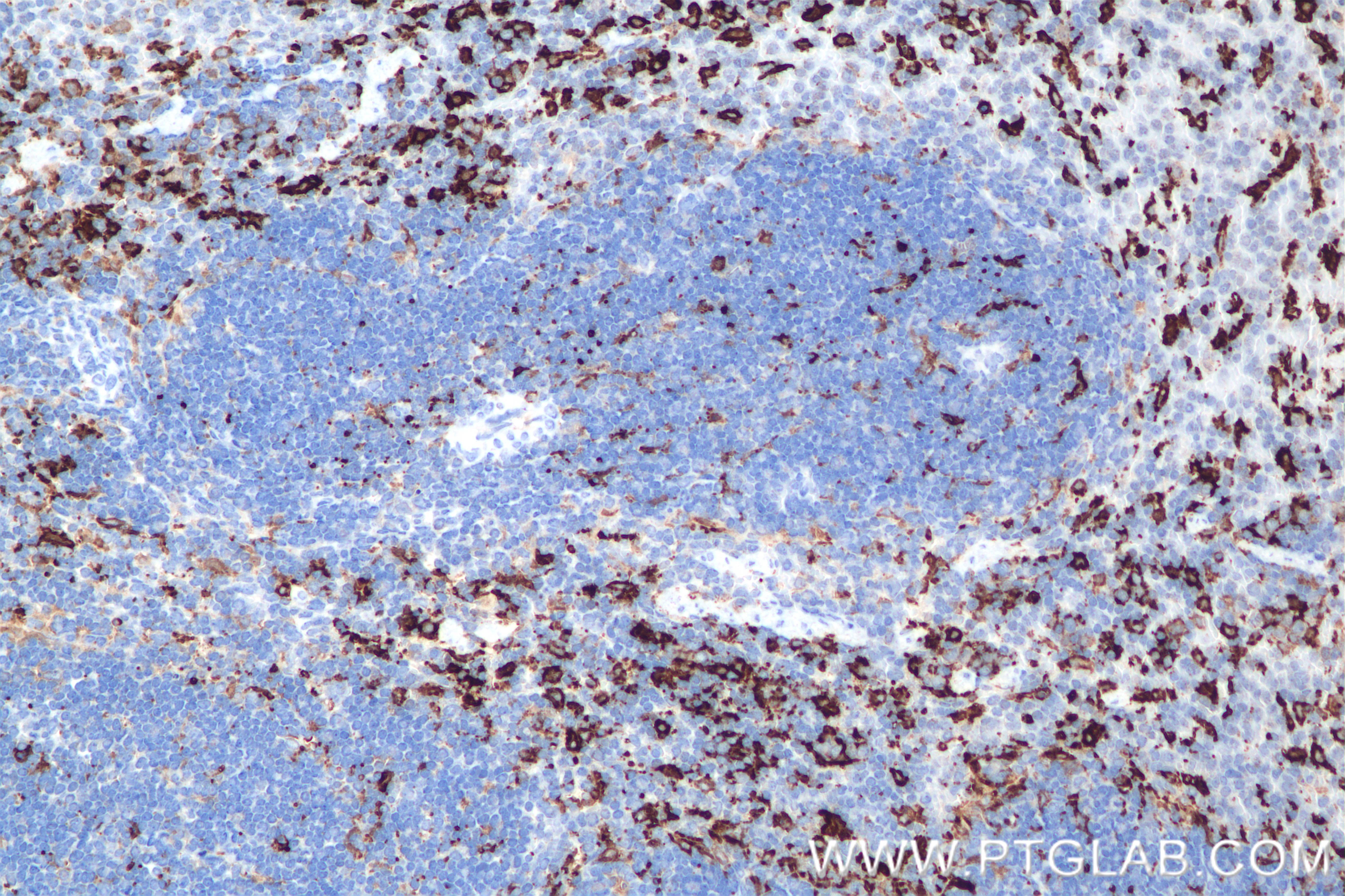 IHC staining of mouse spleen using 84431-5-RR