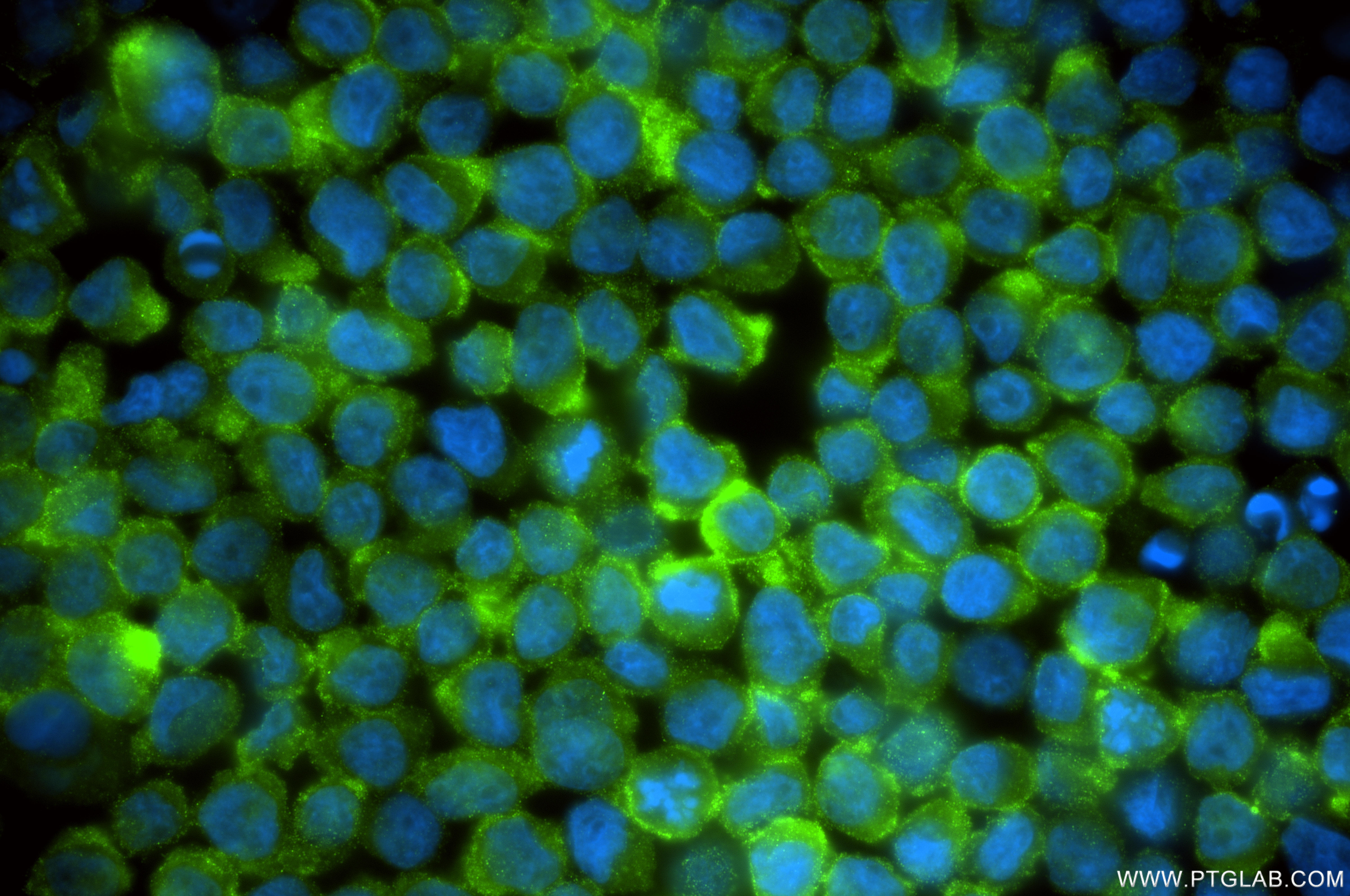 IF Staining of THP-1 using 85321-2-RR IF Staining of THP-1 using 85321-2-RR