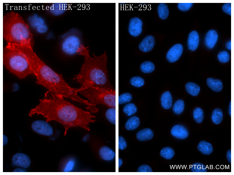 IF Staining of Transfected HEK-293 using 87367-3-RR IF Staining of Transfected HEK-293 using 87367-3-RR
